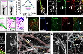 Image result for actin�metr9