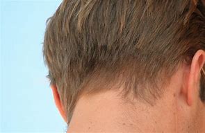 Image result for 9Mm Hair Length