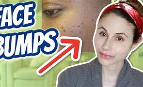 Image result for How to Get Rid of Bumps On Face