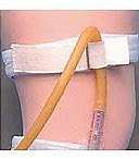 Image result for Nephrostomy Tube Bag Holder