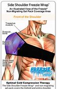 Image result for How Long Does a Sprained Shoulder Take to Heal
