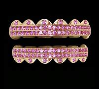 Image result for Pink Diamond Grillz