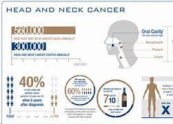 Image result for Head and Neck Cancer Staging