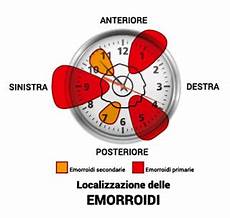 immagini emorroidi interne emorroidi interne ed esterne cura sintomi cause rimedi immagini emorroidi interne emorroidi interne ed esterne cura sintomi cause rimedi