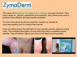 Image result for Mollusum Treament Topical