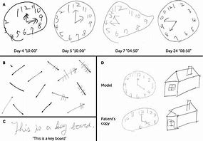 Image result for Clock Drawing and Facial Recognition Test