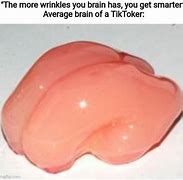 Image result for What Is Smooth Brain