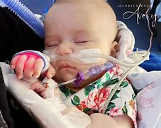 Image result for Baby PICC Line