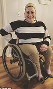 Image result for People with Spina Bifida