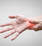 Image result for Bruised Wrist