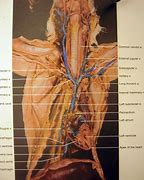 Image result for Internal Mammary Vein