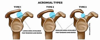 Image result for wcromial