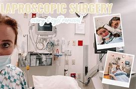 Image result for Ovarian Cyst Removal Surgery