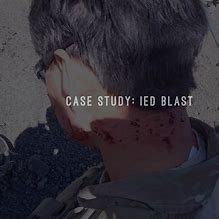 Image result for IED Blast Injuries