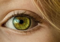 Image result for Myopia Vision Example