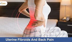 Image result for Uterine Fibroids and Back Pain