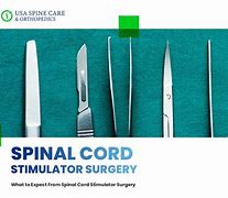 Image result for Sprint Spinal Cord Stimulator