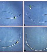 Image result for Locking Pigtail Catheter