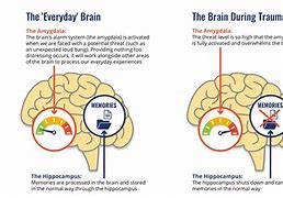 Image result for What Do Brains Look Like