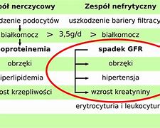 Image result for co_to_za_zespół_nefrytyczny