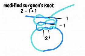 Image result for Vicryl Suture
