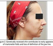 Image result for Sharp Angular Jawline Women