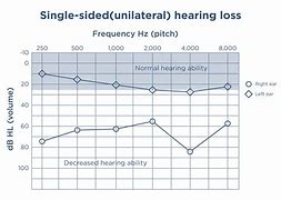 Image result for Audiogram to Boost iPhone Volume