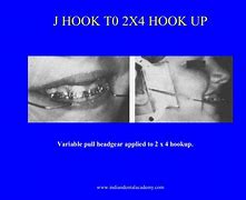 Image result for J-Hook Headgear