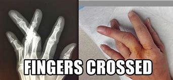 Image result for Fingers Crossed Meme