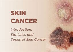 Image result for Non-Melanoma Skin Cancer