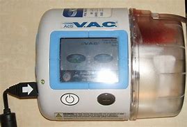 Image result for Medical Device Charging