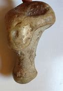 Image result for Petrified Bone Joint