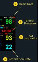 Image result for Heart Monitor in Hospital Line