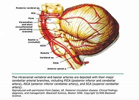 Image result for Posterior Circulation Brain