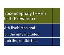 Image result for Holoprosencephaly