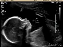 Image result for 24 Weeks Pregnant Ultrasound
