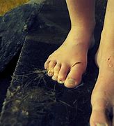 Image result for Ugly Toes