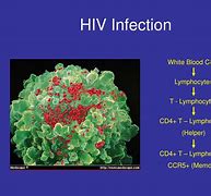 Image result for HIV infection