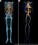 Image result for Whole Body 3D Scan
