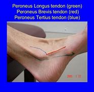 Image result for Peroneus Longus and Brevis Palpation