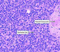 Image result for Thymic Epithelial Cells