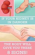 Image result for How I Lost My Kidney Meme Woman