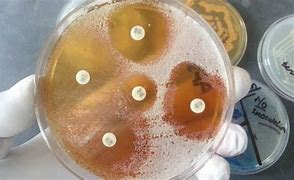 Image result for candida_tropicalis