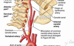 Image result for internal carotid arteries anatomy