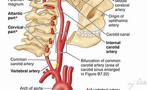 Image result for Cavernous Carotid Artery
