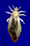 Image result for Giant Sea Lice