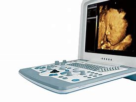 Image result for Portable Ultrasound Scanner