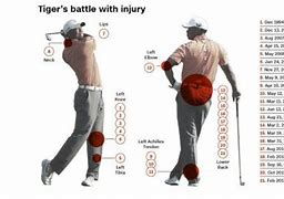 Image result for Tiger Woods Injuries