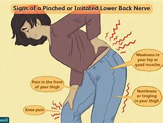 Image result for Pinched Nerve Lower Back Pain