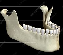 Image result for Jawbone Teeth